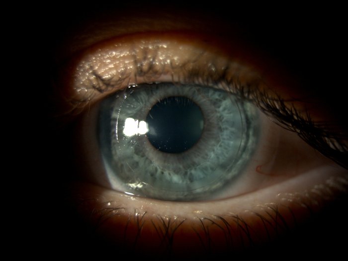 Hybride lens Hybride lens